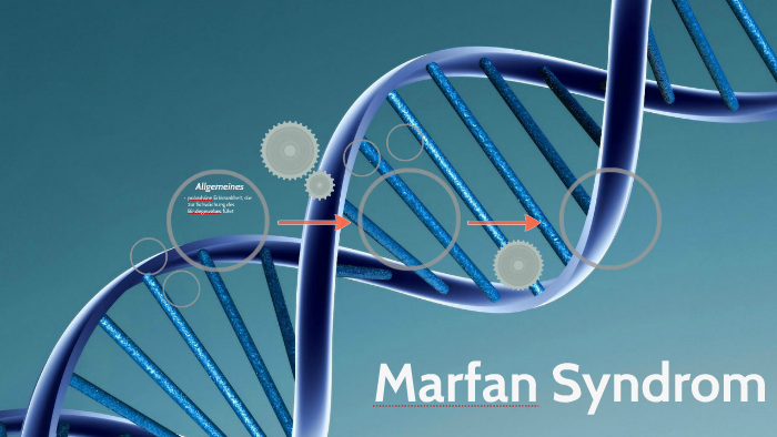 Marfan Syndrom by leon Remmelberger