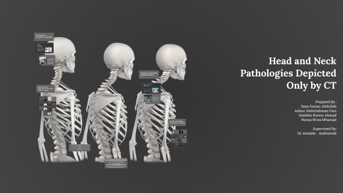 Head and Neck Pathologies Depicted Only by CT by Saya Osman on Prezi