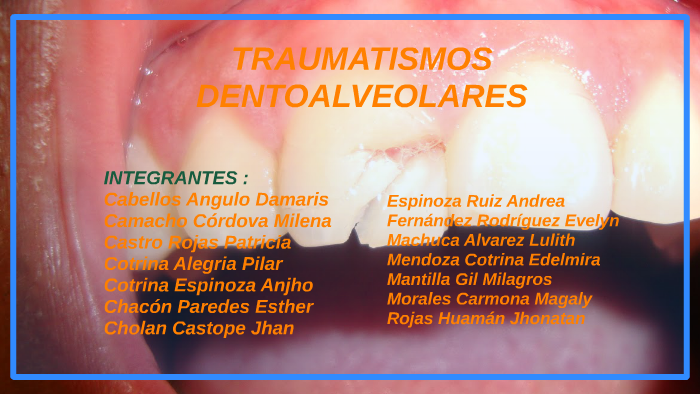 TRAUMATISMOS DENTOALVEOLARES by Anjho Cotrina Espinoza on Prezi