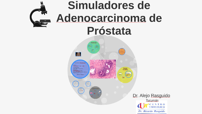 pin de próstata de alto y bajo grado 4