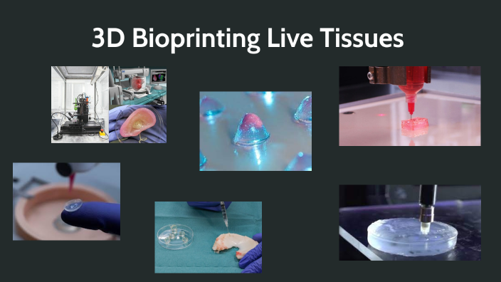 3D Bioprinting Live Tissues By Isa Ess On Prezi