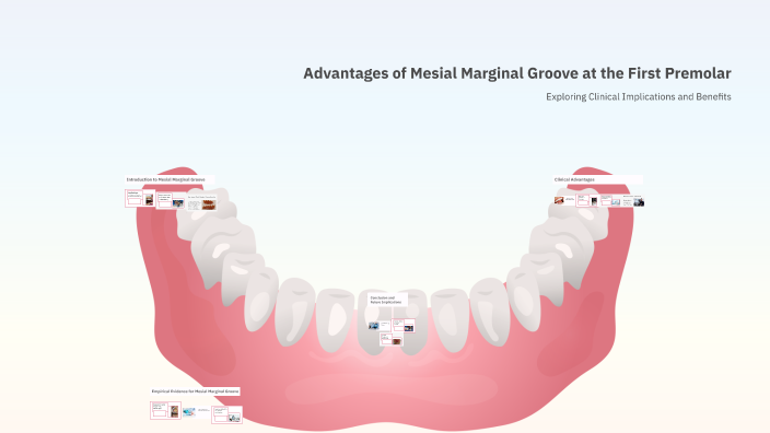 Advantages of Mesial Marginal Groove at the First Premolar by Salma ...