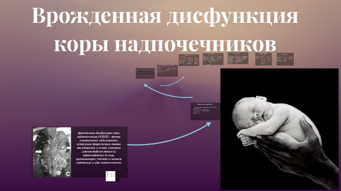 Врожденная дисфункция коры надпочечников презентация