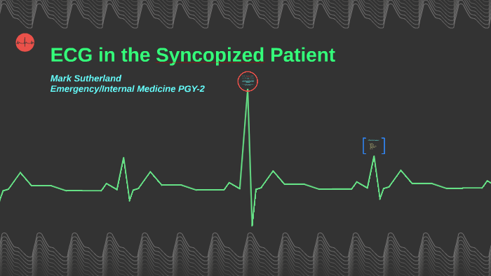 ECG in the Syncopized Patient by Mark Sutherland