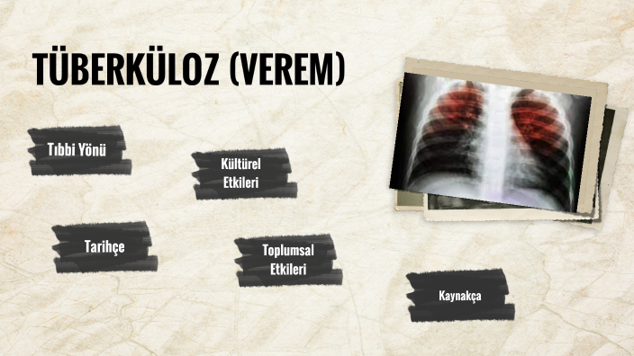 verem by zeynep yön on Prezi