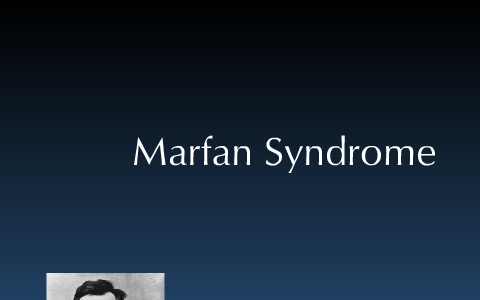 Marfan Syndrome by Michael Booker on Prezi