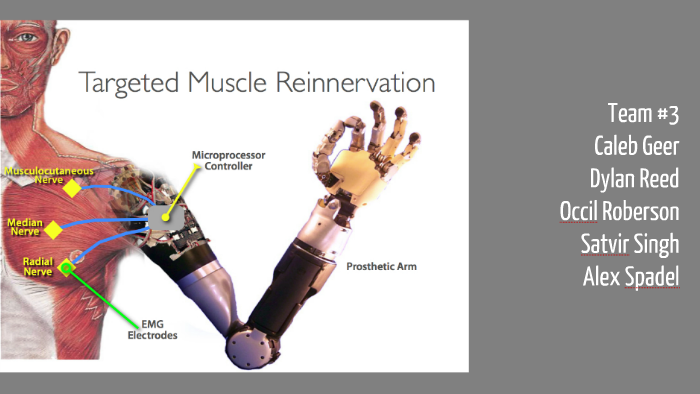 Targeted Muscle Reinnervation (TMR) By Dylan Reed On Prezi