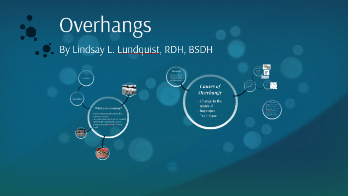 Overhangs by Lindsay Lundquist on Prezi