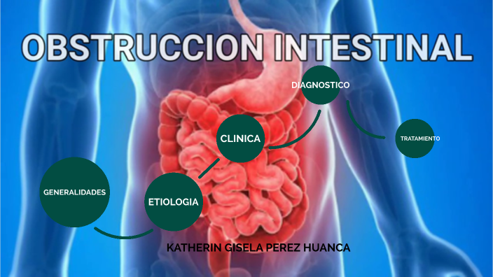 OBSTRUCCION INTESTINAL by Katherin Perez