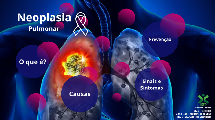 Neoplasia Pulmonar by Ivandra Santos on Prezi