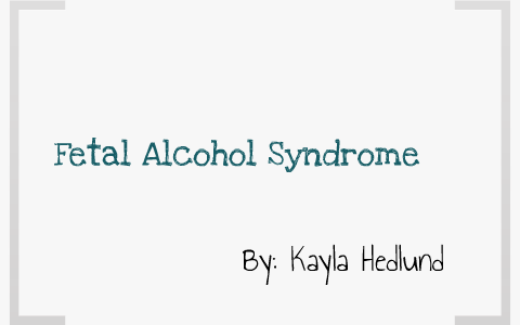 Fetal Alcohol Syndrome by Kayla Hedlund on Prezi