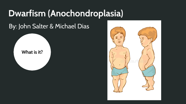 Dwarfism (Achondroplasia) by John Salter on Prezi