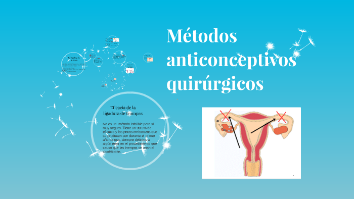 Métodos anticonceptivos quirúrgicos by Eduardo Tapia Villegas on Prezi