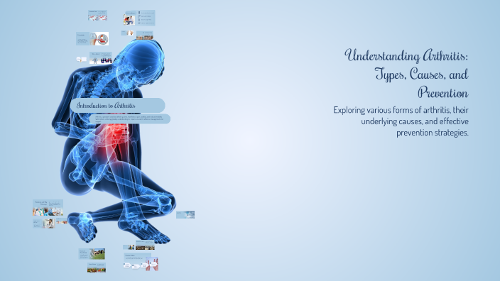 Understanding Arthritis: Types, Causes, and Prevention by Infinity on Prezi