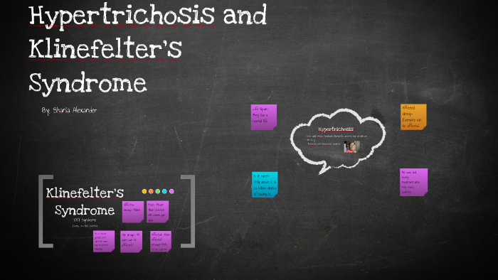 Hypertrichosis And Klinefelters Syndrome By Shania Alexander 