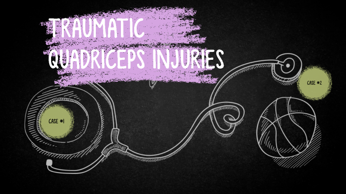 Quadriceps Injuries by Ryan Kennedy on Prezi