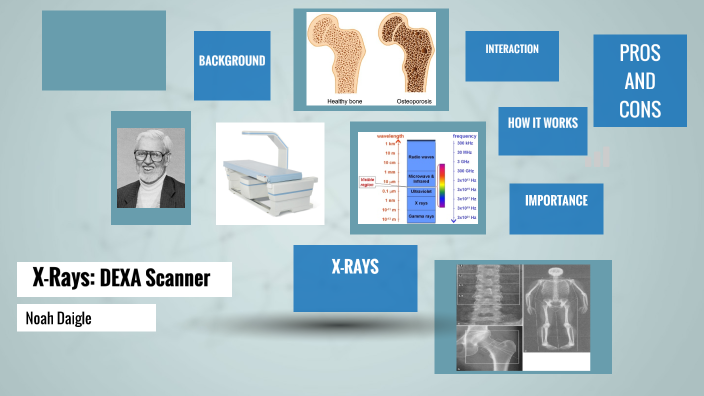 Children Bone Density Scanner Exhibit By Noah Daigle On Prezi