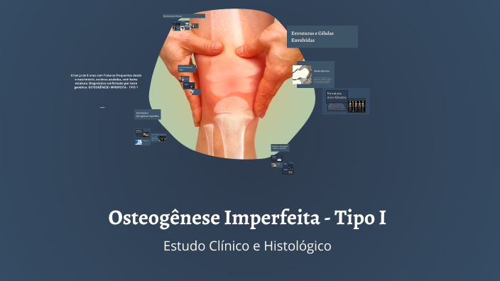 Osteogênese Imperfeita - Tipo I by guilherme recofka on Prezi