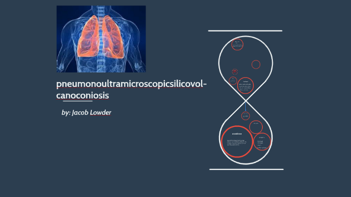 pneumonoultramicroscopicsilicovolcanoconiosis by Jacob Lowder on Prezi
