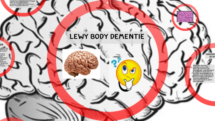 lewy body dementie by Renske Weller on Prezi