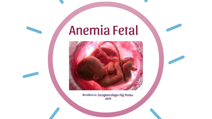 Anemia Fetal by sol gilardi on Prezi