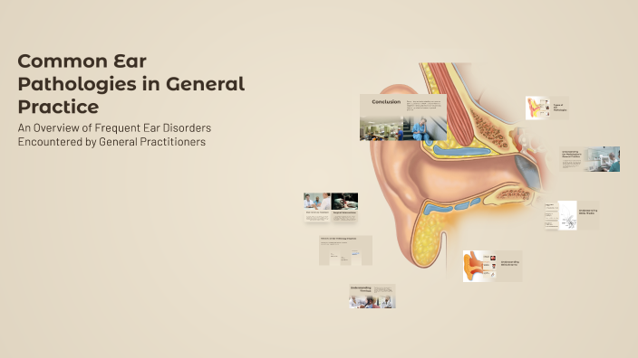 Common Ear Pathologies in General Practice by Saba Kanwal on Prezi