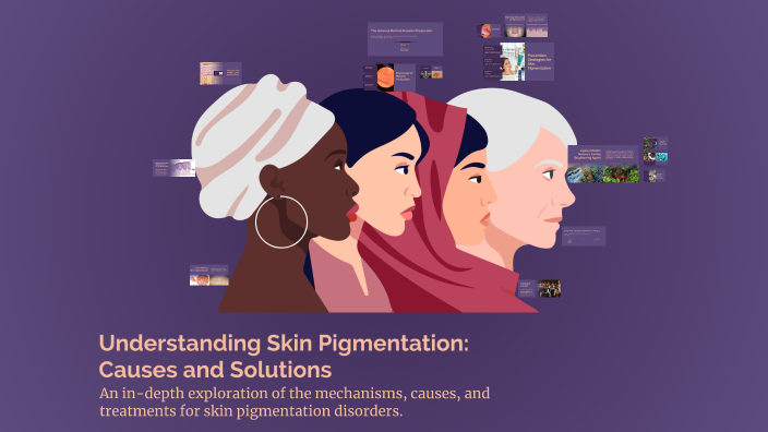 Understanding Skin Pigmentation: Causes and Solutions by Hala Alghwiri ...