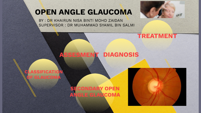 OPEN ANGLE GLAUCOMA By KHAIRUN NISA MOHD ZAIDAN On Prezi