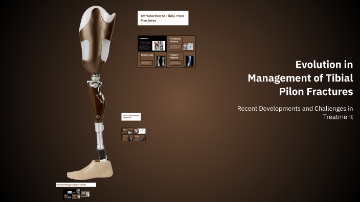 Evolution in Management of Tibial Pilon Fractures by Vivek Bilolikar on ...