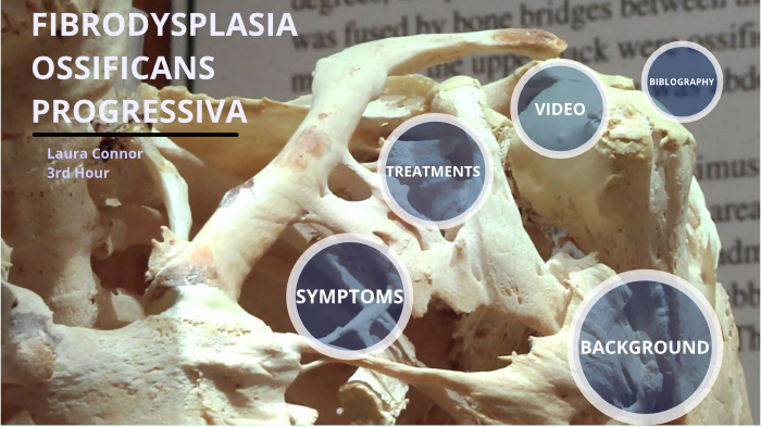 Fibrodysplasia Ossificans Progressiva by laura connor on Prezi