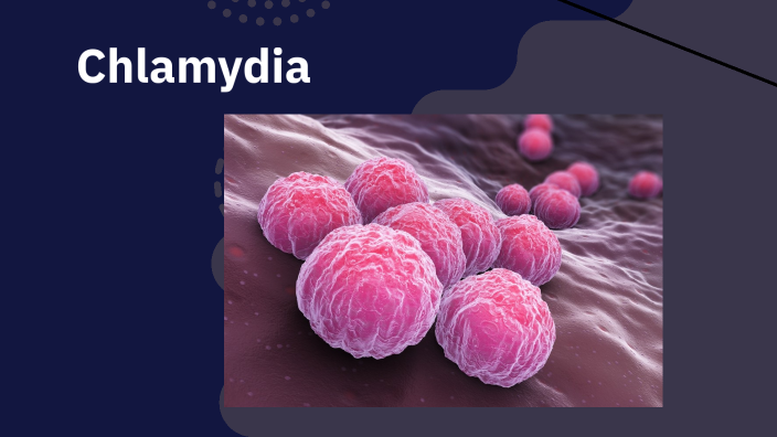 Sexually Transmitted Infections by Daniel Lee on Prezi