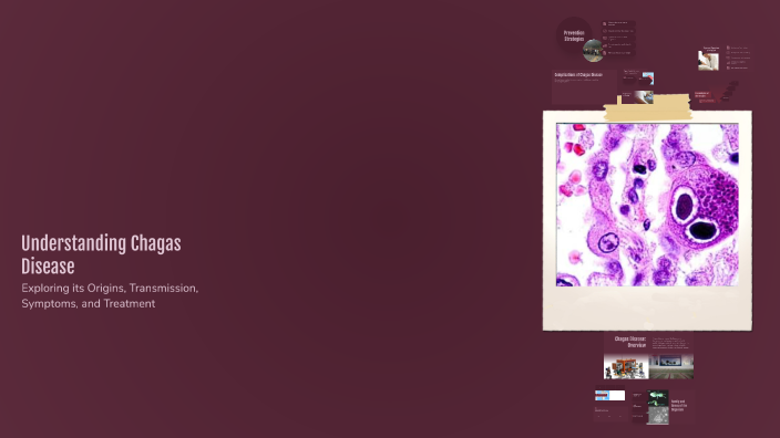 Understanding Chagas Disease by Marline Kani on Prezi