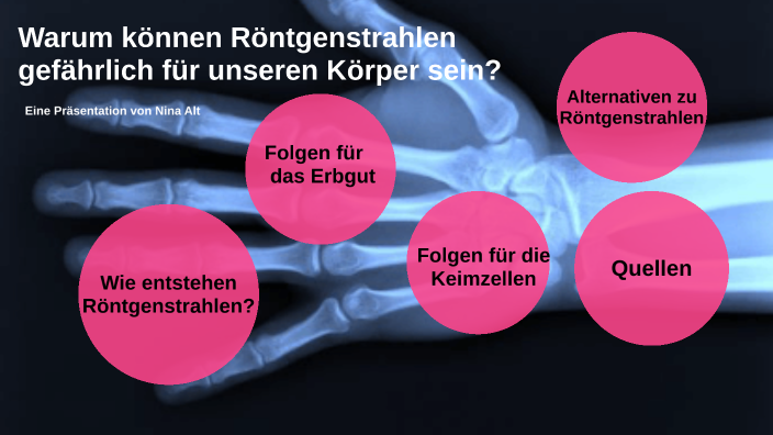 Warum können Röntgenstrahlen gefährlich für unseren Körper sein? by ...