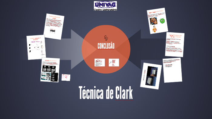 Técnica De Clark By Amanda Marangon On Prezi