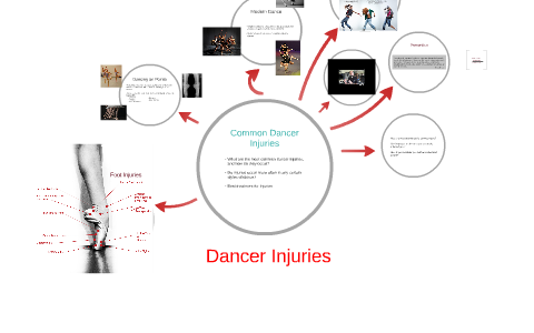 Dancer Injuries by on Prezi