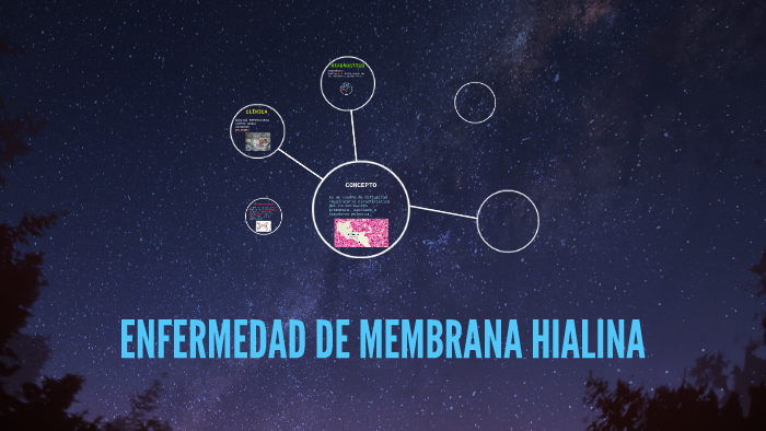 ENFERMEDAD DE MEMBRANA HIALINA by ALEIDA MIRANDA on Prezi