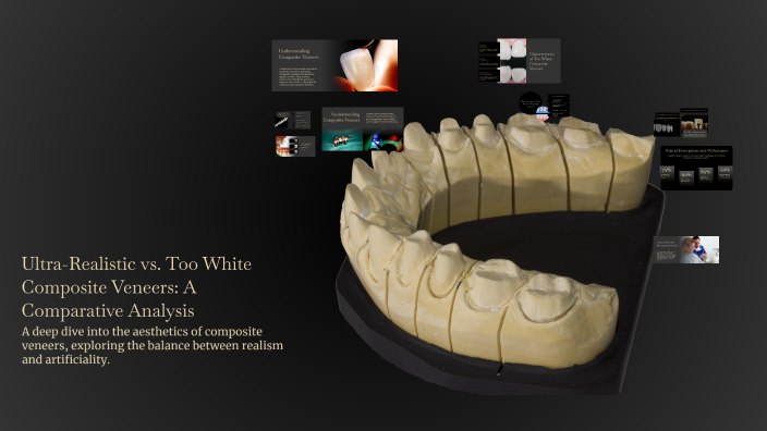 Ultra-Realistic vs. Too White Composite Veneers: A Comparative Analysis ...