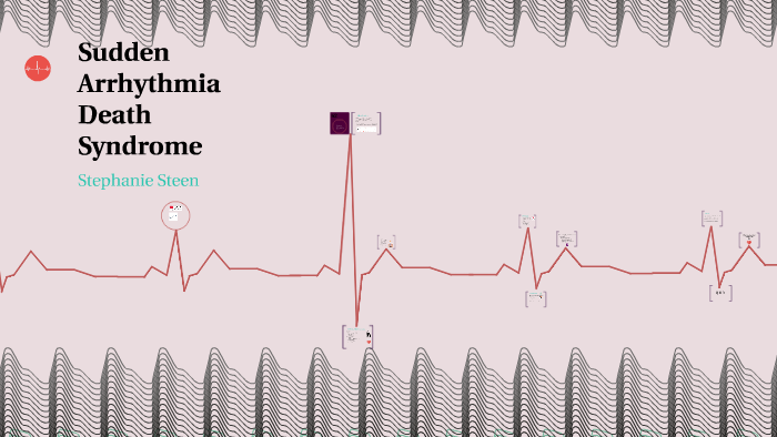 Sudden Arrhythmia Death Syndrome by Stephanie Steen on Prezi