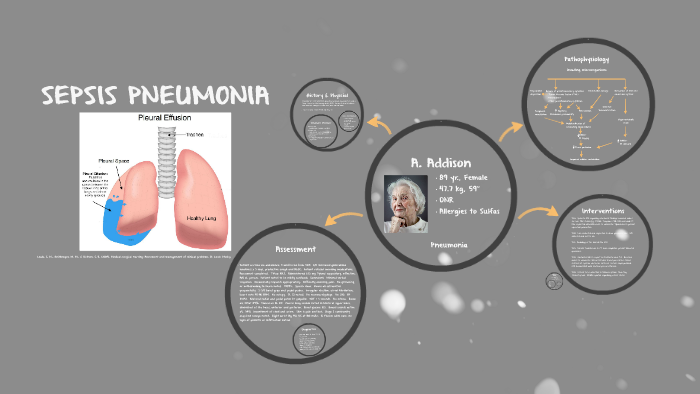 Sepsis Pneumonia by Cinthia Orosco on Prezi