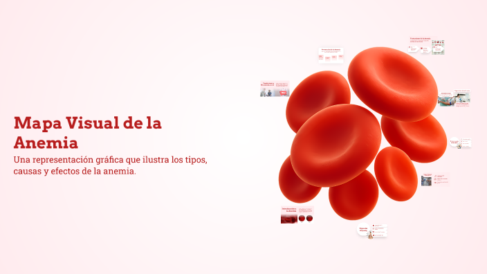 Mapa Visual de la Anemia by Angelo Severino palacios on Prezi