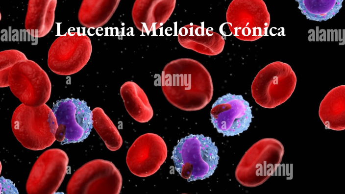 Leucemia mieloide crónica by ruth parís peña on Prezi