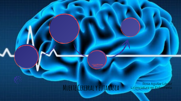 Muerte Cerebral Y Eutanasia By Rosa Aguilar On Prezi