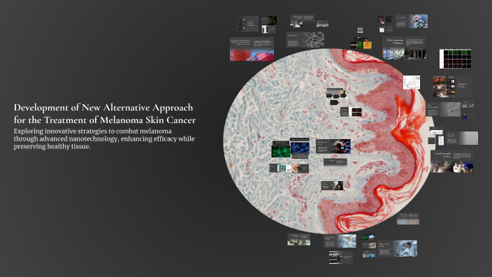 Development of New Alternative Approach for the Treatment of Melanoma ...