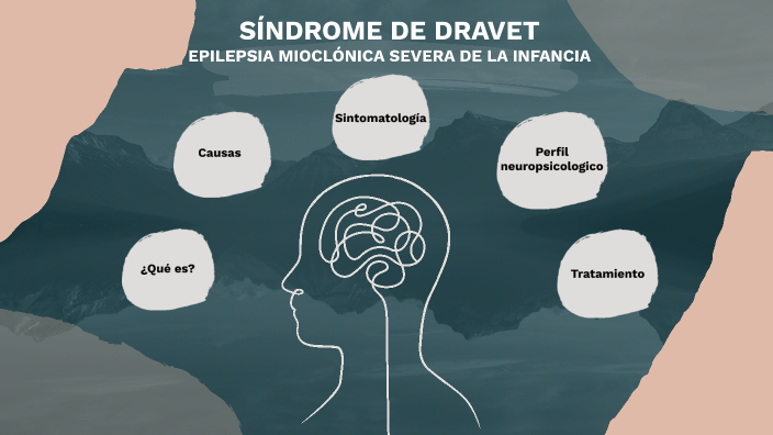 Síndrome de Dravet by Julia Rodriguez Molina on Prezi