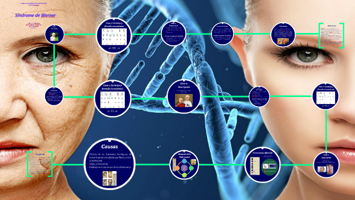 Síndrome de Werner by Soley Roman on Prezi