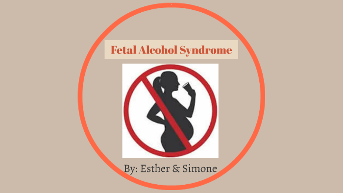 Fetal Alcohol Syndrome by Simone & Esther English on Prezi