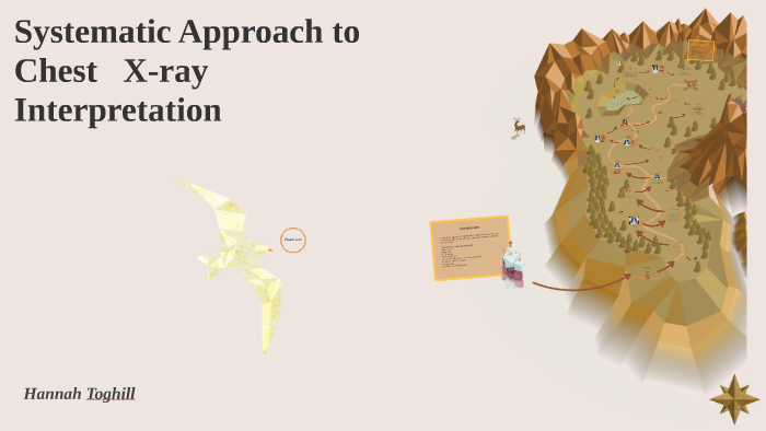 Systematic Approach to Chest X-ray Interpretation by Hannah Toghill on ...