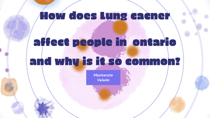 how-does-lung-cancer-affect-peop0le-in-ontario-and-why-is-it-so-common