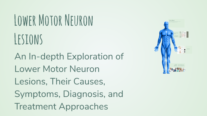 Lower Motor Neuron Lesions by Mohamed Khaled on Prezi