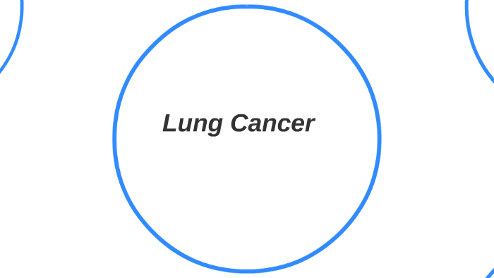 Lung Cancer by Ryan Jones on Prezi